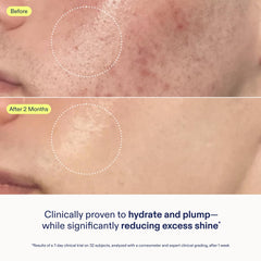 Piel con aspecto más suave y luminoso gracias a Skinfix Gel Crema Barrera.