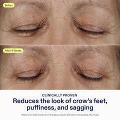 Skinfix con ceramidas 3 por ciento para retener humedad en la zona ocular.