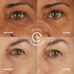 Parches con Ginkgo y antioxidantes para deshinchar e iluminar la mirada