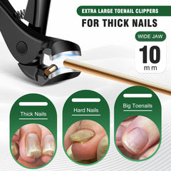 SMZHealing levantador de uñas para facilitar la higiene diaria.