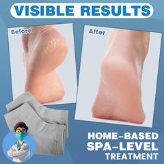 Chaussettes TEAWOO sans orteils, douceur et protection contre les frottements.
