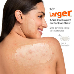 TKTK acne patch absorbs moisture and debris for back, chest, and shoulders.