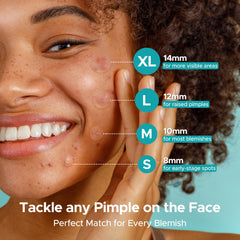 TKTK easy-peel film for smooth patch removal.