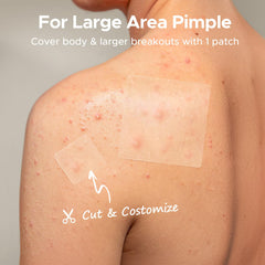 Parche TKTK para el mentón, 60 mm, ayuda a tratar brotes grandes.