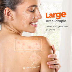 Parche TKTK para acne en la nariz, protege y absorbe el exceso de sebo.