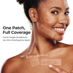 TKTK Pimple Patches 8mm dot patch for small blemishes