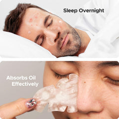 Puntos de acné redondos TKTK 8mm 10mm 12mm para manchas aisladas.