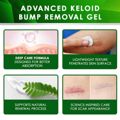 Tobcharm gel texture closeup demonstrates smooth application for scar care