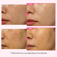 TOSOWOONG Arbutin 7% Crème: application visage facile.