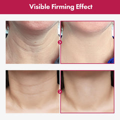 Aplicación diaria de Necktox para definir el contorno del cuello