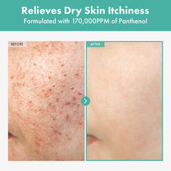 TOSOWOONG Dexpanthenol crema, textura suave y ligera para la piel.
