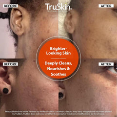 TruSkin Vitamin C Face Wash foamy wash applied to skin in close-up.