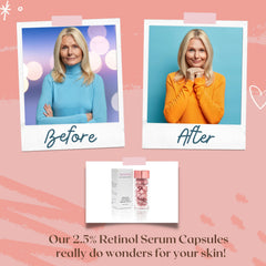 Turbinne cápsulas retinol 2.5%, dosis diaria para rutina efectiva