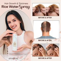 uikeaft uso diario cuidado cabello, opción suave para cabello normal o rizado