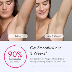 Dispositivo IPL de Ulike para uso rápido en cuerpo completo.