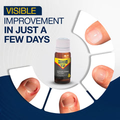 URIEL Kit Retrait Ongle Incarné: ensemble pratique pour une prise en charge à domicile.