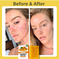 Retinol para renovación suave de la piel y aspecto más firme