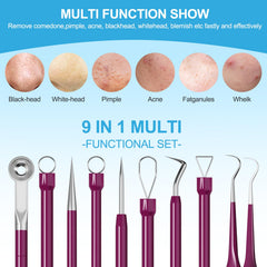 UWOIST espátula facial para limpiar poros, ideal para piel sensible