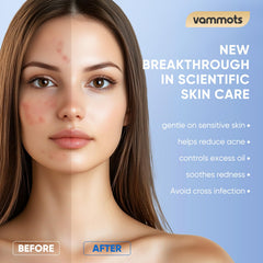 Limpieza facial suave con Vammots para piel sensible y confortable