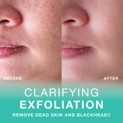 VITAMINS AND SEA BEAUTY exfoliante con piedra pómez natural para renovación de piel