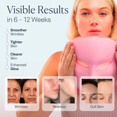 VogueNow scrubber-ultrasonico-facial limpieza profunda para la piel