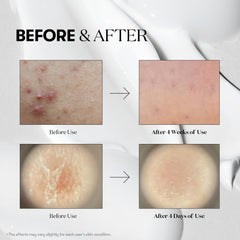 VT COSMETICS Reedle Shot 700 frasco para revitalizar la piel y su vitalidad.