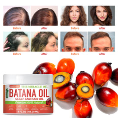 Wealthskin Batana Aceite: mascarilla para cabello dañado que ayuda a repararlo