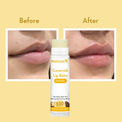 WishCare bálsamo labial para uso diario y protección diaria