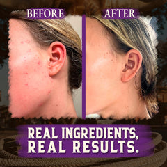 Wrath & Remedy miel de Manuka y aceites orgánicos, nutrición para la piel