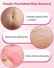 Aceites naturales XUEBEIK helicriso para nutrición suave de la piel.