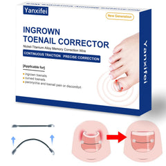 Yanxifei Correcteur d’Ongle Nitinol - boîte prête à l’emploi pour essai à domicile.