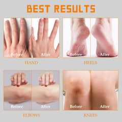 YOUNGYOUNGLOVE bottle shows tea tree oil, vitamin E, aloe vera, and shea butter.