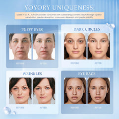 YOYORY parche ocular: empaque de 30 pares para uso diario y viaje