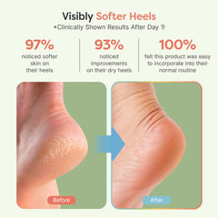 ZenToes aceite de jojoba y oliva con vitamina E para hidratación profunda.