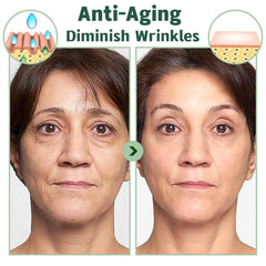 zhnnt aporta vitamina C y ácido hialurónico para hidratación prolongada