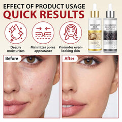 ZIXAOK dos ampollas exfoliante arroz, conjunto para consistencia