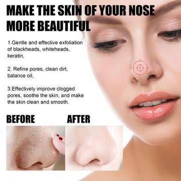 Aacnre Centella mask offers oil-control potential for clearer skin
