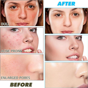 Aacnre exfoliante cúrcuma, cuidado diario para rostro y cuerpo.