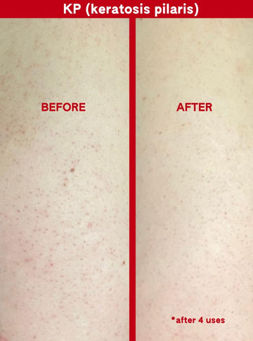 Piel radiante tras primer uso, exfoliante corporal Abi Ame para resultados visibles.