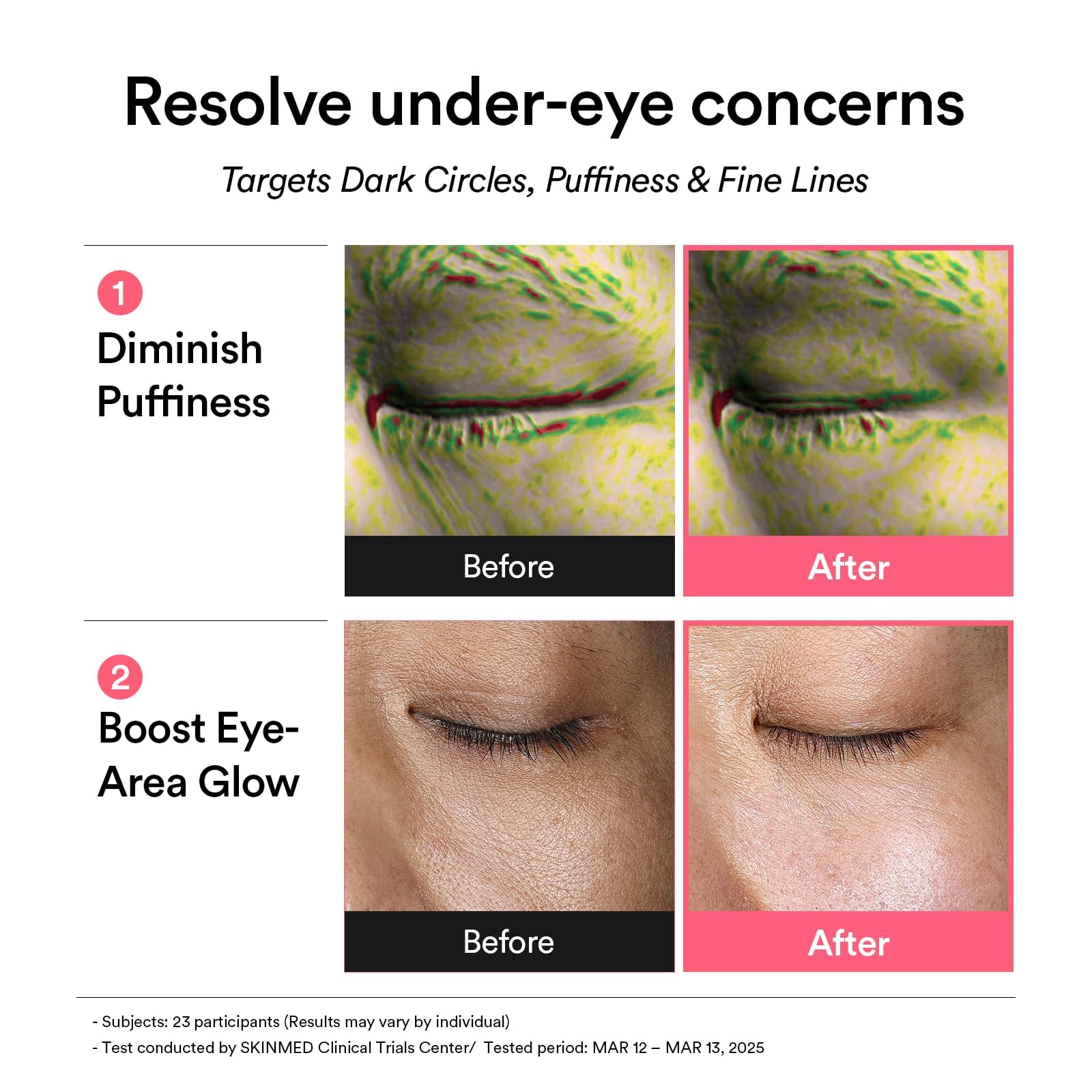 Abib PDRN eye patch helps soften fine lines around the eyes and temples