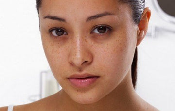 Application de la crème ACM Depiwhite sur le visage