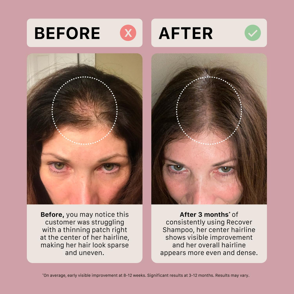 ACTIIV Recover champú apto para todo tipo de cabello.