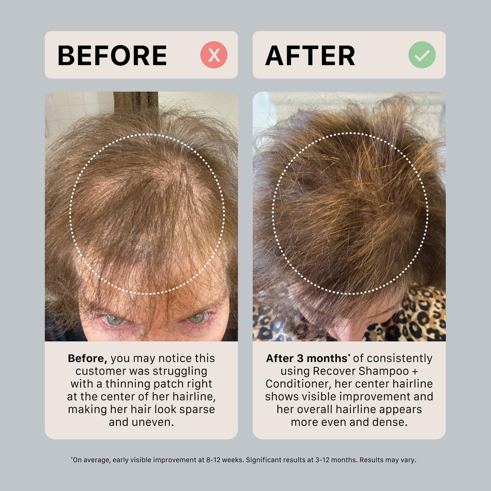 ACTIIV Recover Acondicionador cabello sano y brillante gracias a su fórmula