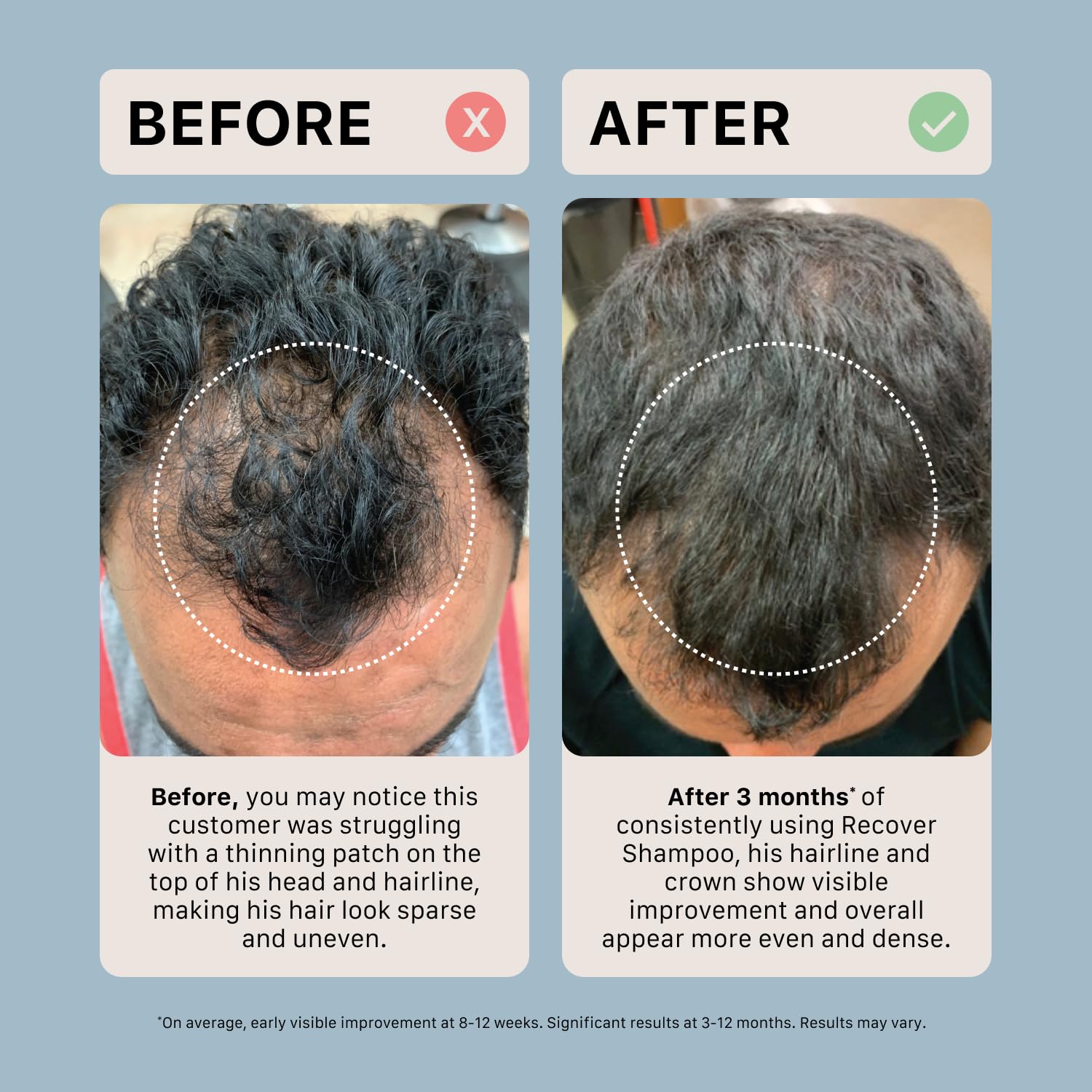 ACTIIV Recover champu cabello volumen: apariencia mas llena tras lavado