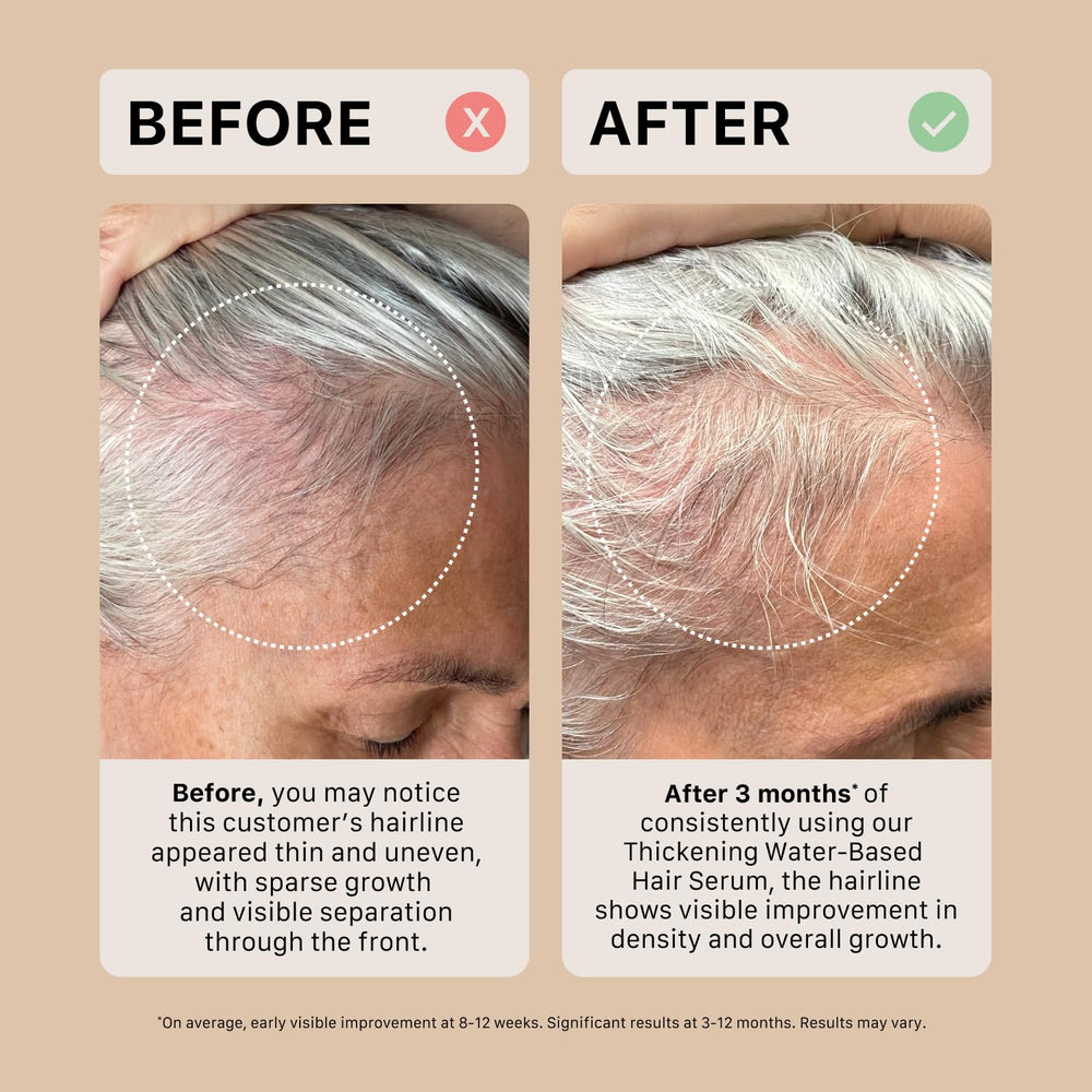 ACTIIV suero espesante para cabello, resultados visibles con el tiempo.