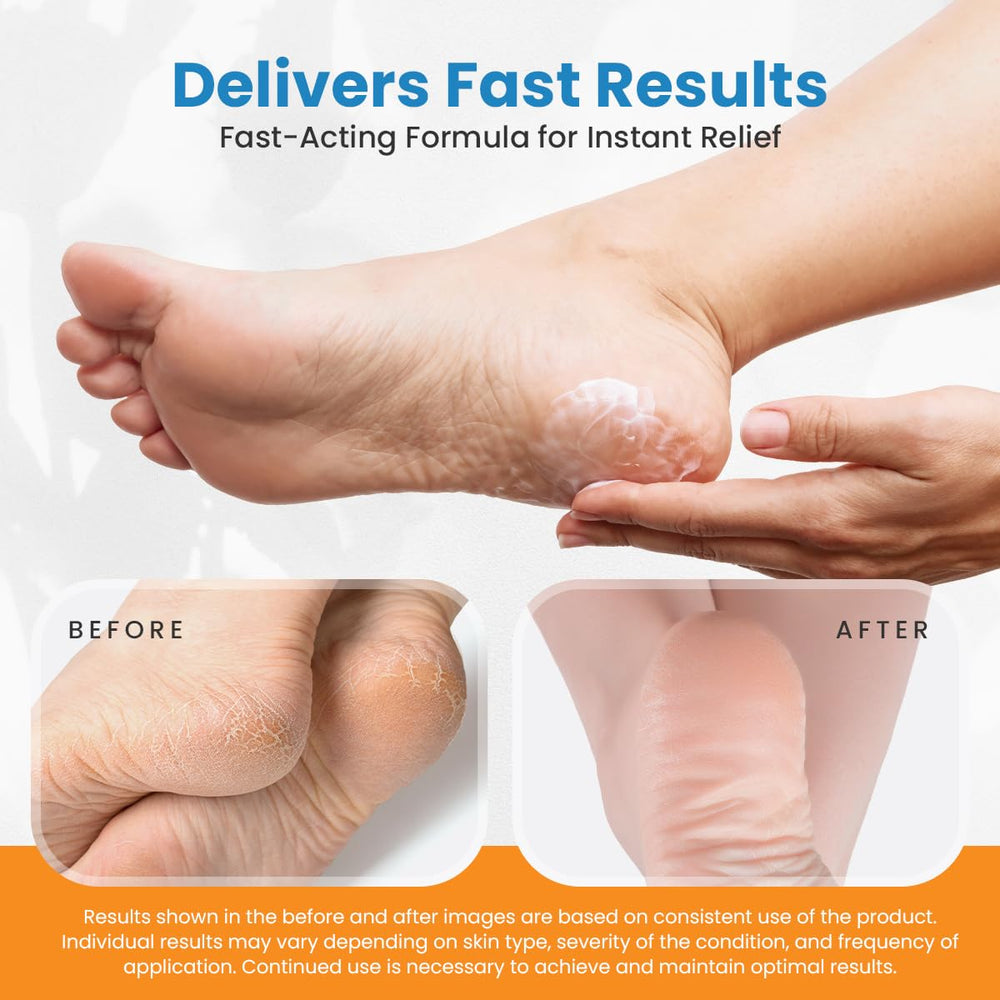 Activelife Revitaderm 4D crema-pies-nutricion-botanica: cuida zonas ásperas con aloe y manzanilla
