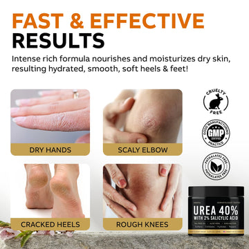 Adellina Urea Cream 40% for cracked heels.