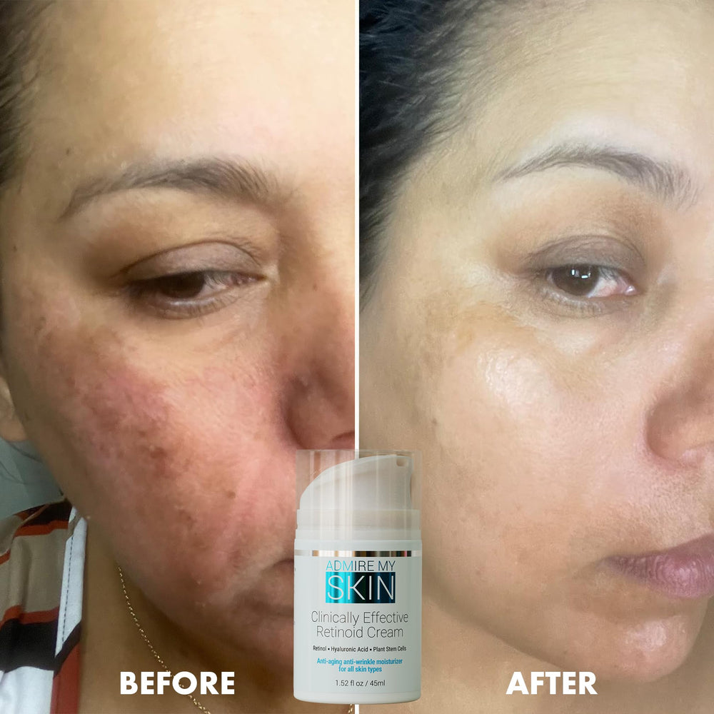 Ingredientes clave de Admire My Skin Potent Retinoid Cream para la piel.