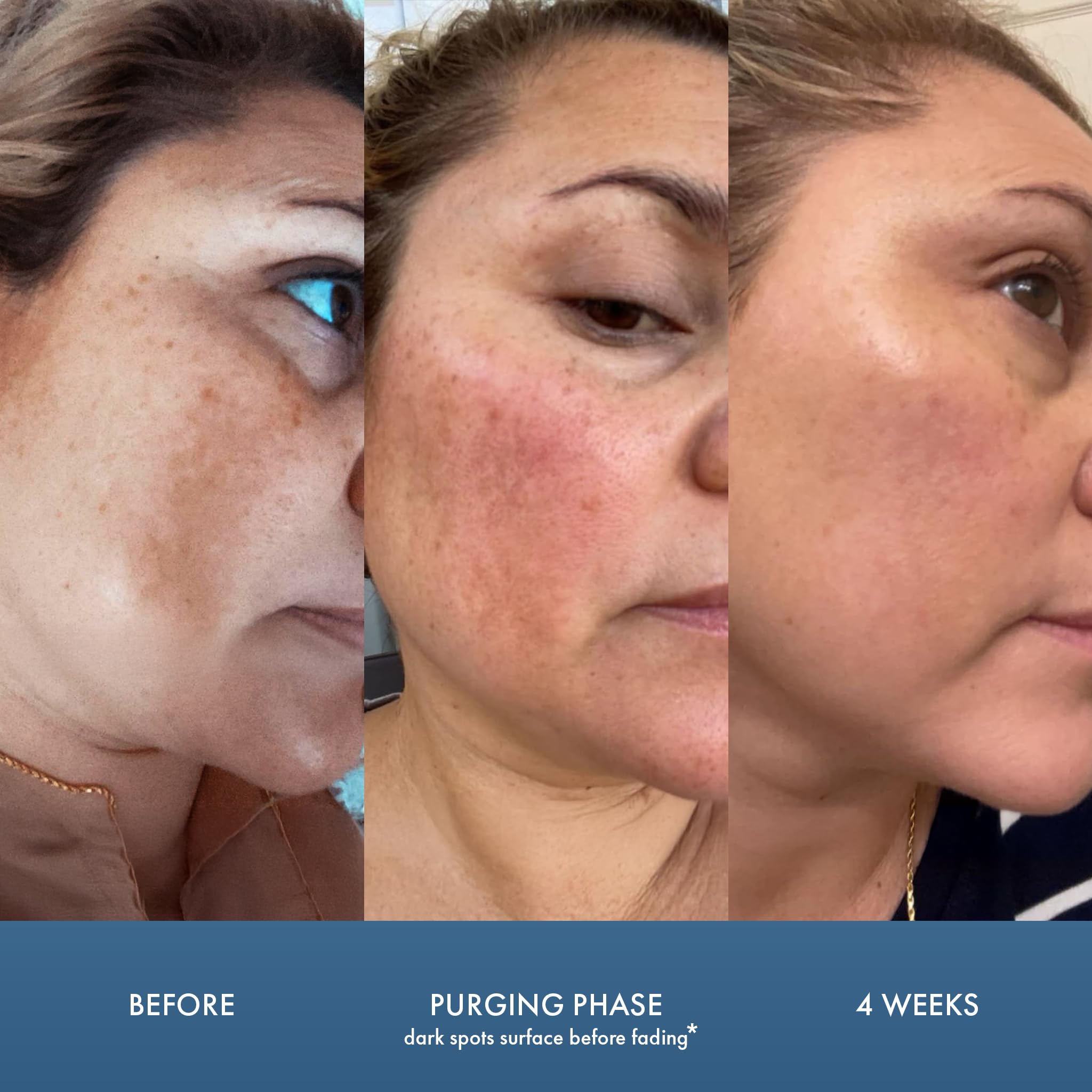 Serum Admire My Skin en envase compacto, facilita uso diario.