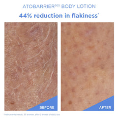 AESTURA ATOBARRIER365 exfoliación suave con PHA para textura más uniforme.